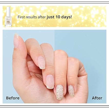 Eveline 8 in 1 nail conditioner with golden particles before and after results